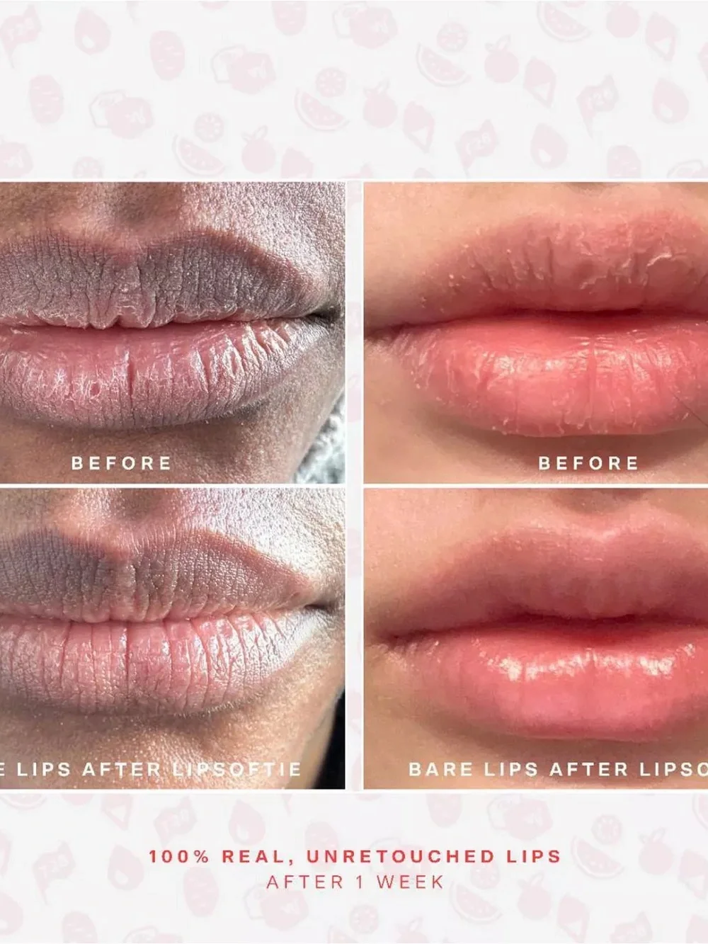 TOWER 28 BEAUTY LIPSOFTIE HYDRATING TINTED LIP TREATMENT BALM;—SUGAR PLUM